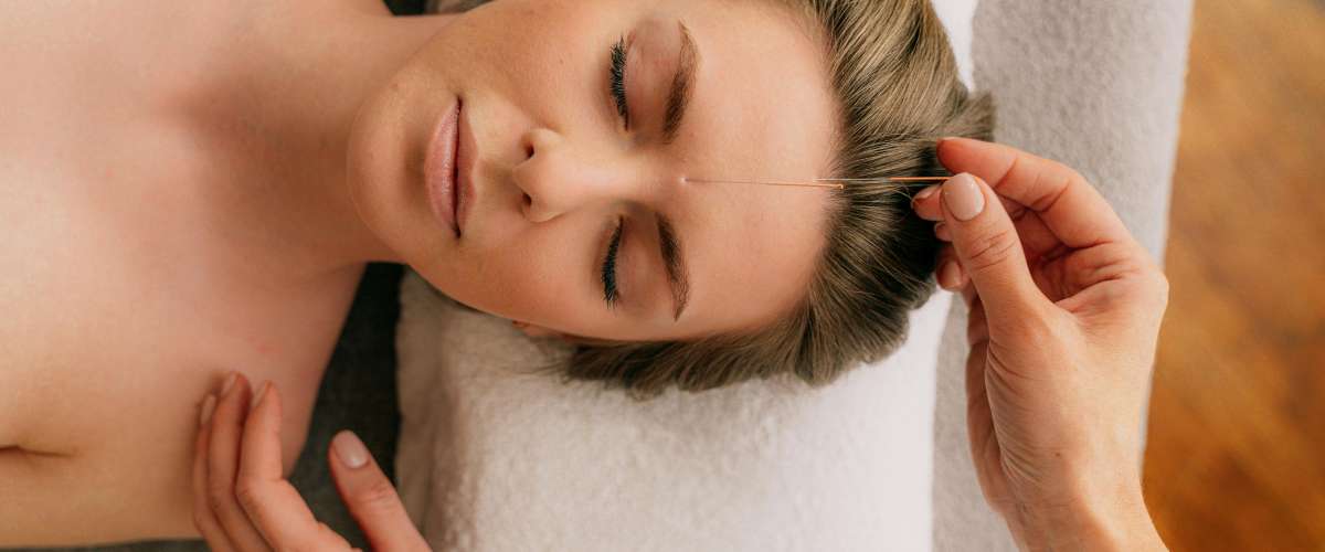 Acupuncture pour acouphenes
